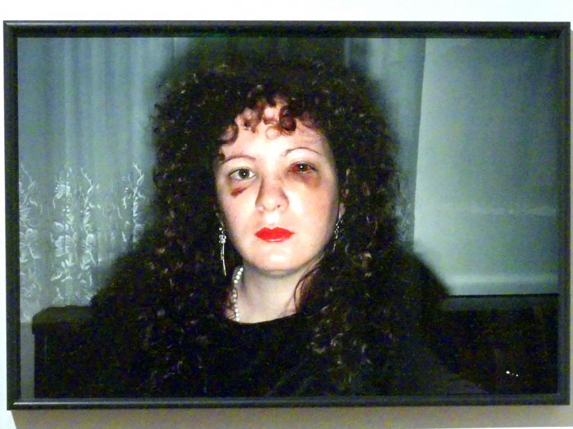 Nan Goldin (1984–1997), Nan einen Monat, nachdem sie geschlagen wurde, Prag, Nationalgalerie im Salm-Palast, Ausstellung "Möglichkeiten des Dialogs" vom 02.12.2018-01.12.2019, Saal 4, 1984